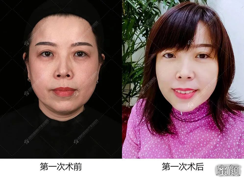 https://img.miyanlife.com/mnt/timg/210701/220H2F12-10.jpg