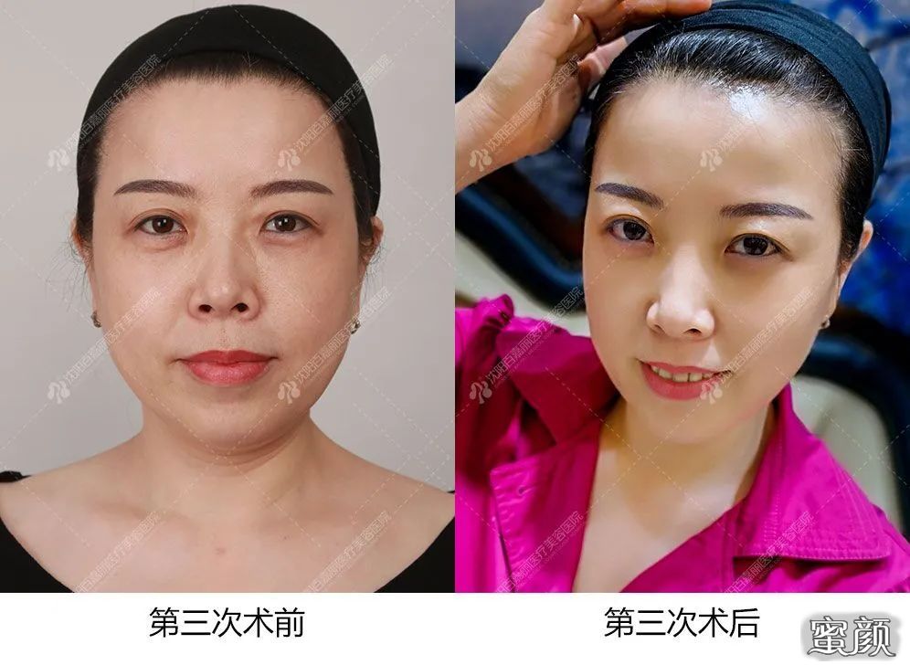 https://img.miyanlife.com/mnt/timg/210701/220H31245-12.jpg