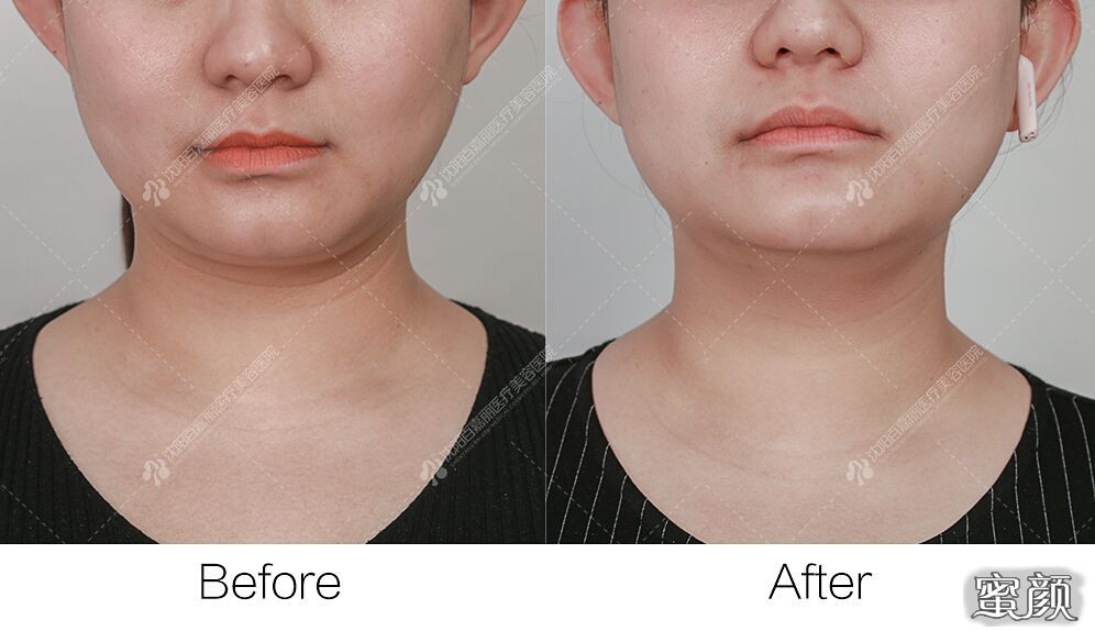 https://img.miyanlife.com/mnt/timg/210701/220H51K1-13.jpg