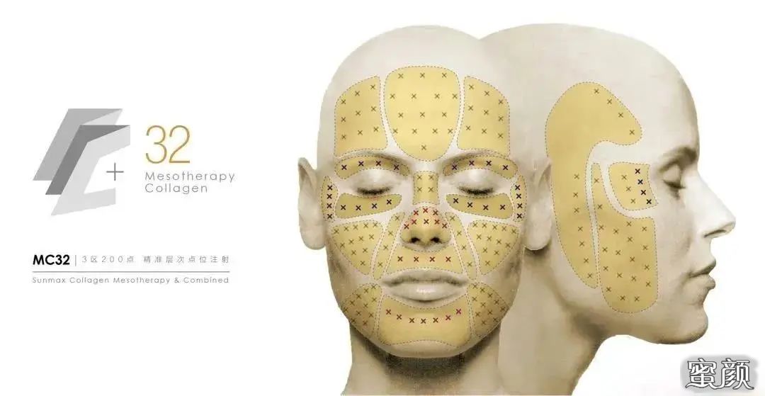 https://img.miyanlife.com/mnt/timg/210703/19334QE2-1.jpg
