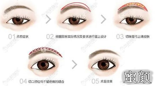 https://img.miyanlife.com/mnt/timg/210707/1222354556-0.jpg
