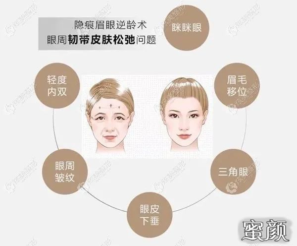 https://img.miyanlife.com/mnt/timg/210707/1222364c5-1.jpg