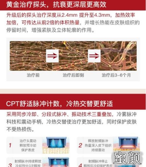 https://img.miyanlife.com/mnt/timg/210709/002J1J13-0.jpg