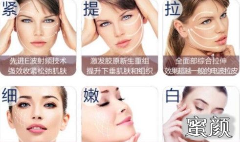 https://img.miyanlife.com/mnt/timg/210709/002KCQ7-2.jpg
