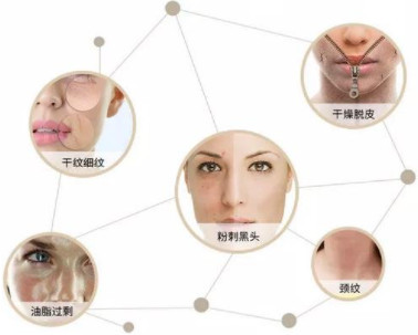 https://img.miyanlife.com/mnt/timg/210709/1G45U3H-0.jpg