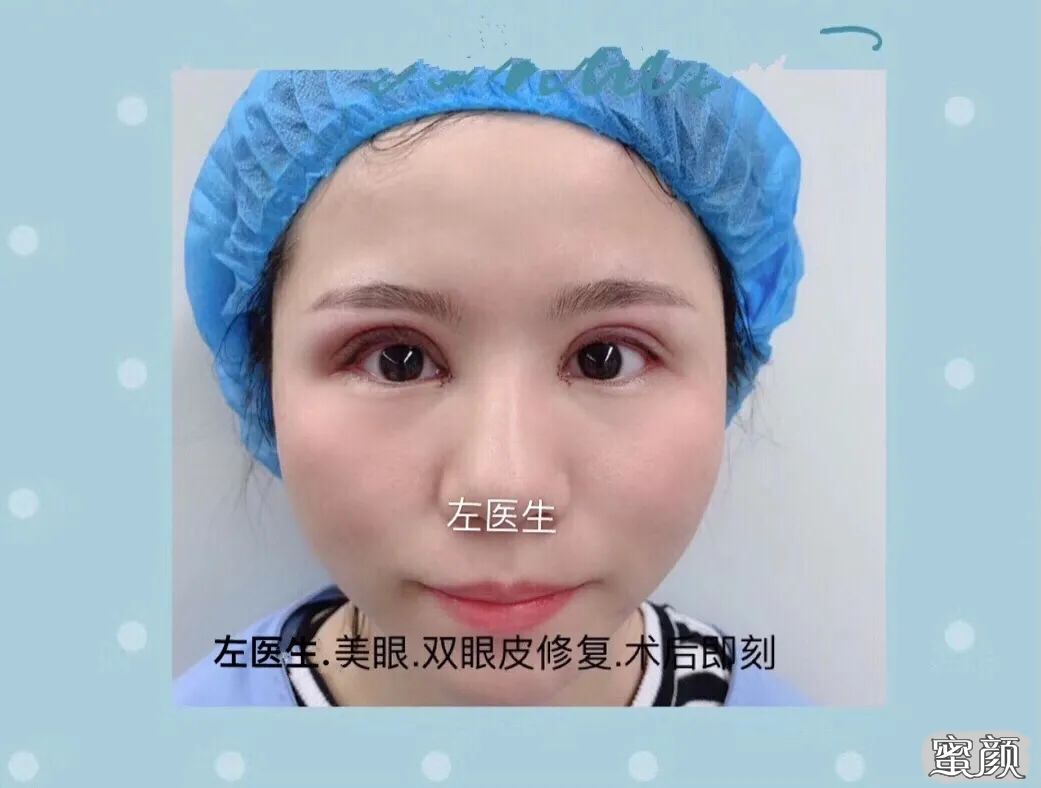 男性の目整形｜Braun Plastic Surgery