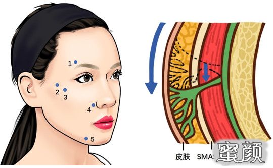 案例图片