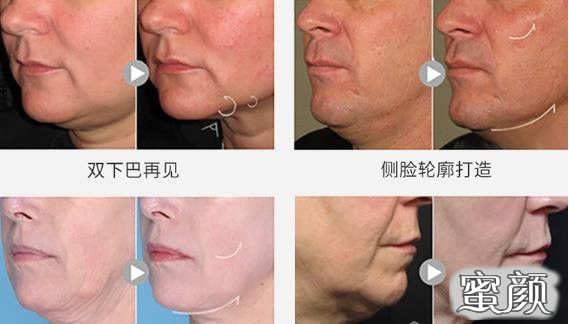https://img.miyanlife.com/mnt/timg/210714/1539555012-3.jpg