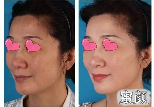 https://img.miyanlife.com/mnt/timg/210717/1H1051408-5.jpg
