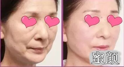 https://img.miyanlife.com/mnt/timg/210717/1H105OH-7.jpg