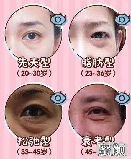 https://img.miyanlife.com/mnt/timg/210718/1H20325K-1.jpg