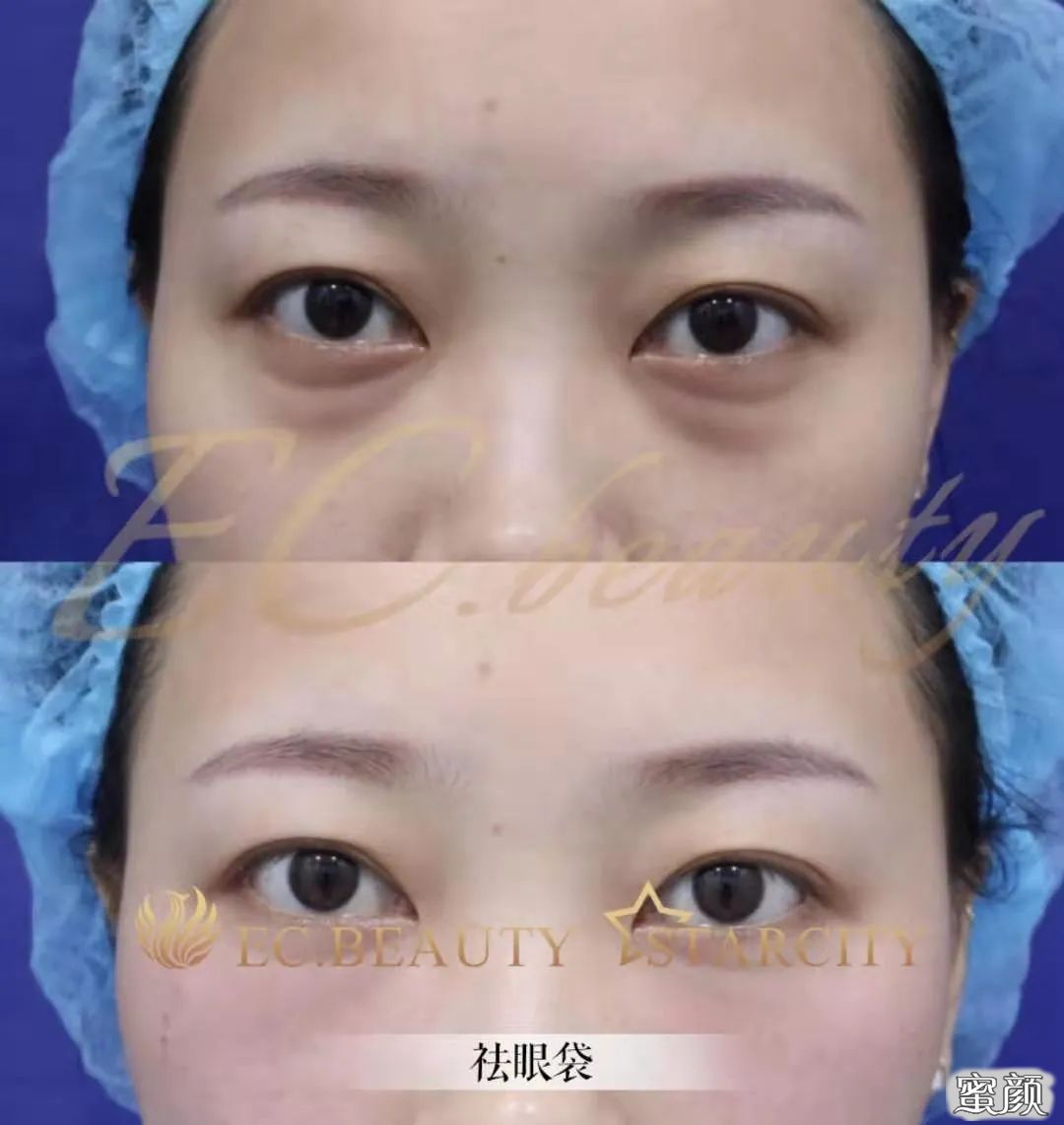 https://img.miyanlife.com/mnt/timg/210718/1H2101445-13.jpg