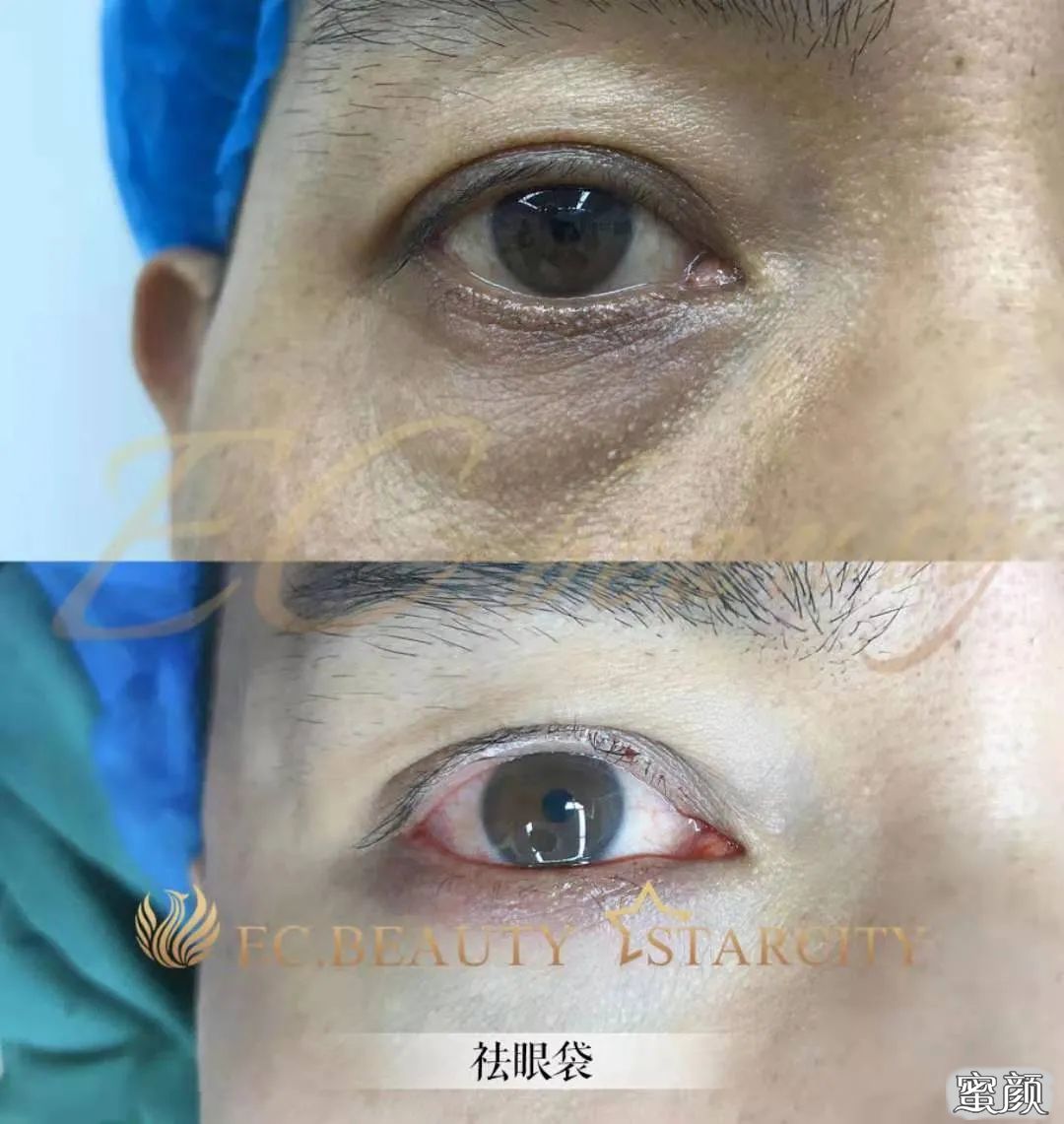 https://img.miyanlife.com/mnt/timg/210718/1H212KT-16.jpg