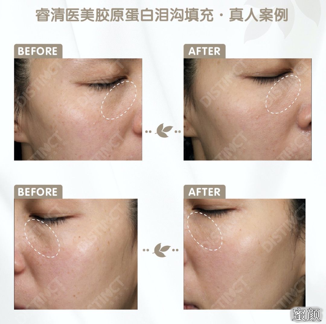 https://img.miyanlife.com/mnt/timg/210719/062F155D-3.jpg