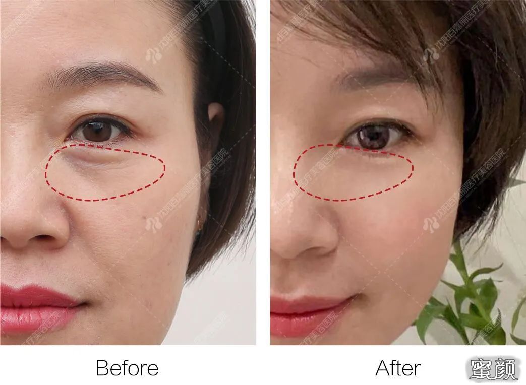 https://img.miyanlife.com/mnt/timg/210719/223230E19-10.jpg