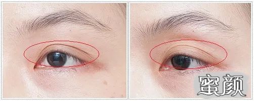 https://img.miyanlife.com/mnt/timg/210721/20563614M-0.jpg