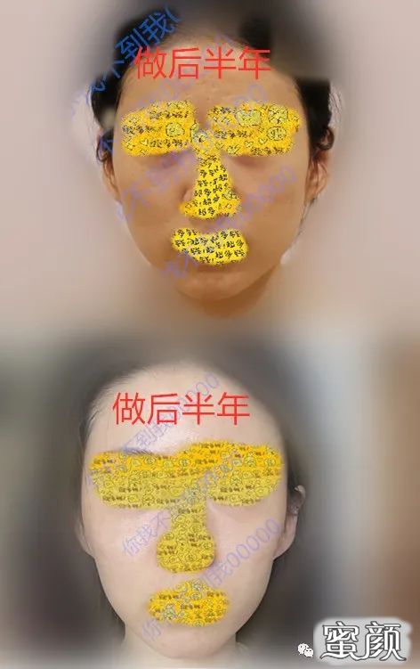 https://img.miyanlife.com/mnt/timg/210725/1PT11Q3-0.jpg