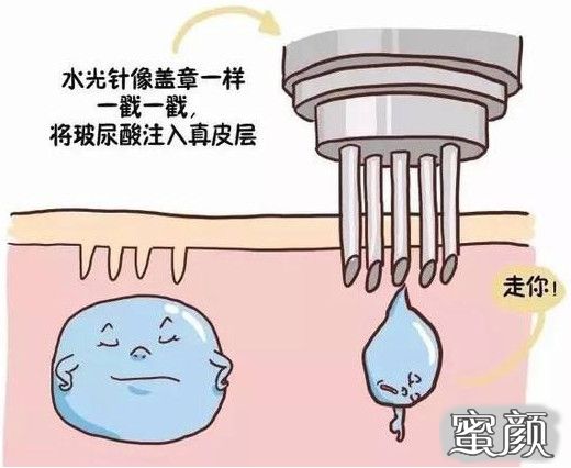 https://img.miyanlife.com/mnt/timg/210726/2103291V9-5.jpg