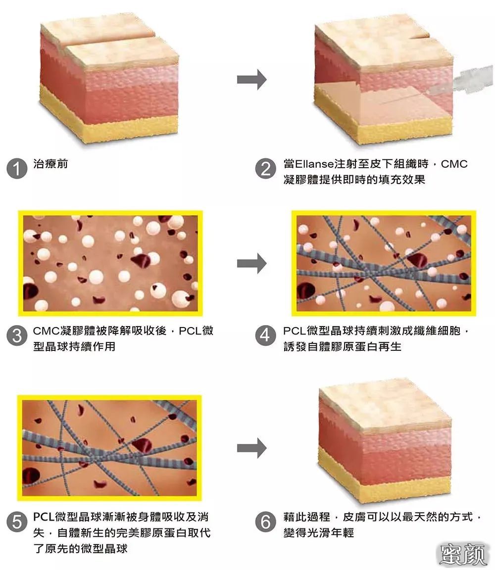 https://img.miyanlife.com/mnt/timg/210728/130210O60-6.jpg