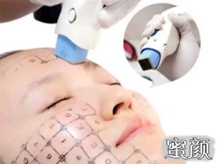 https://img.miyanlife.com/mnt/timg/210806/20054450R-1.jpg