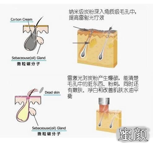 案例图片