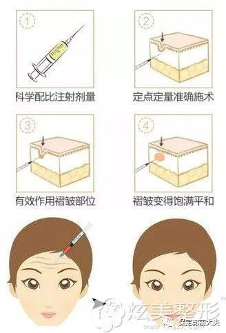 https://img.miyanlife.com/mnt/timg/210811/212A23519-2.jpg