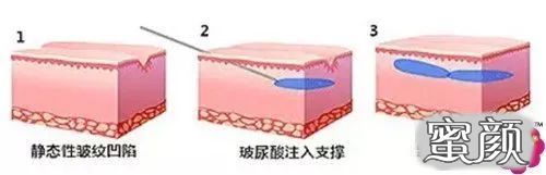 https://img.miyanlife.com/mnt/timg/210811/212A23N4-1.jpg