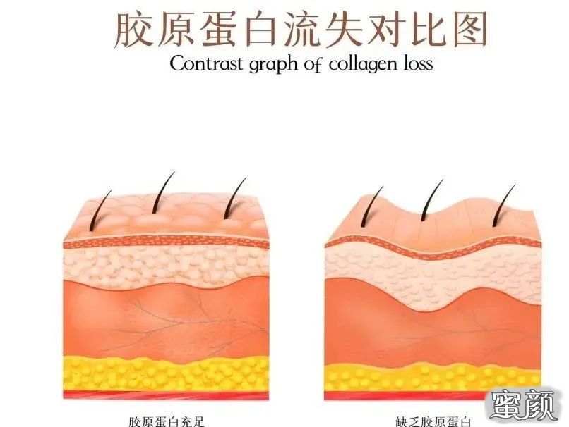https://img.miyanlife.com/mnt/timg/210813/220345D11-2.jpg