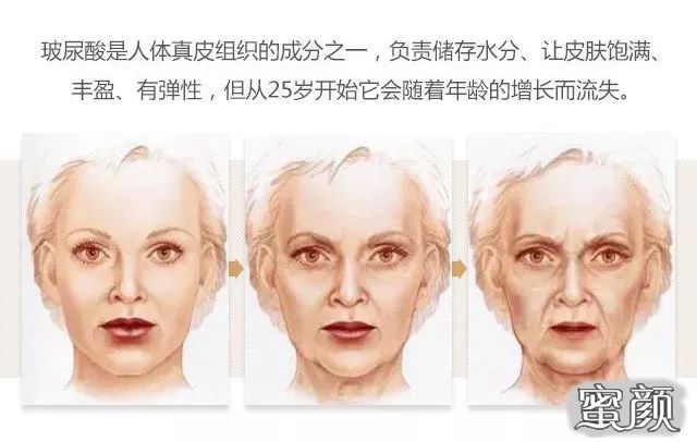 https://img.miyanlife.com/mnt/timg/210814/1R3053952-1.jpg