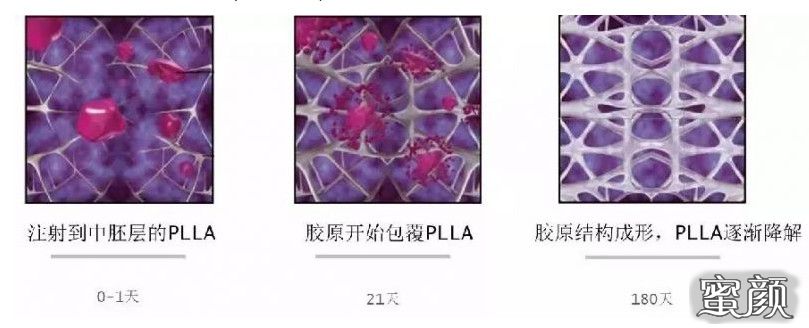 https://img.miyanlife.com/mnt/timg/210817/21005GZ5-0.jpg