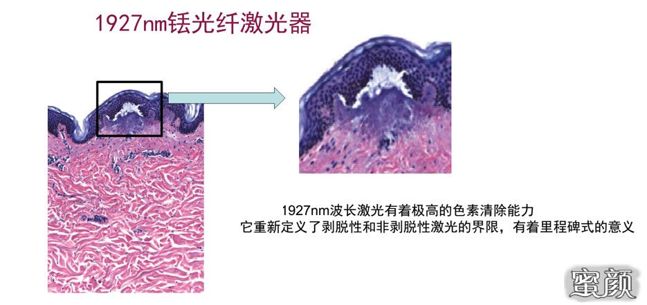 https://img.miyanlife.com/mnt/timg/210817/22591SJ6-6.jpg