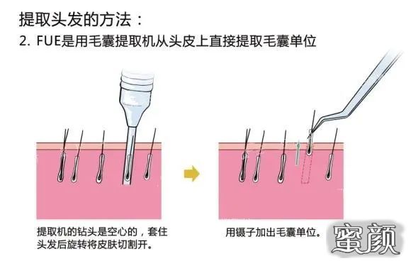 案例图片