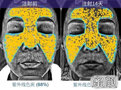 https://img.miyanlife.com/mnt/timg/210901/23301352b-4.jpg
