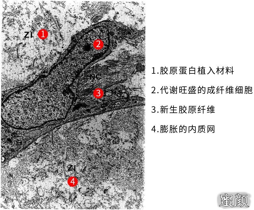 案例图片