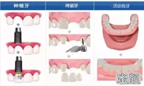 案例图片