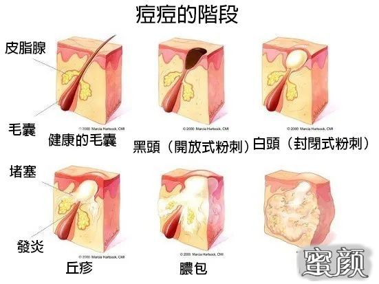 案例图片