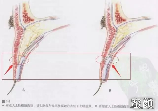 案例图片