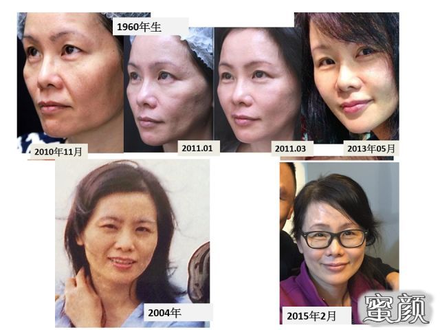https://img.miyanlife.com/mnt/timg/211002/233312HN-5.jpg