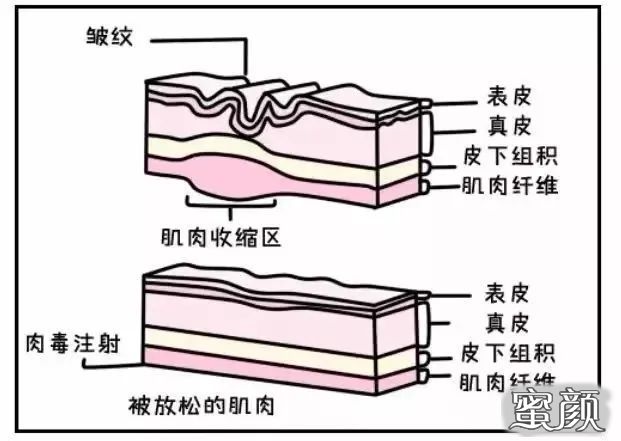 案例图片