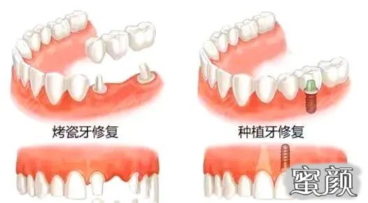 案例图片