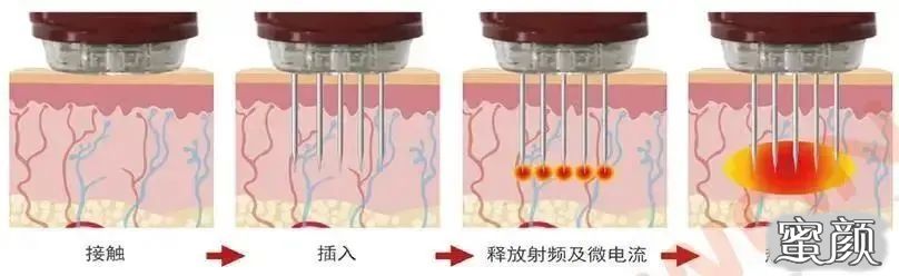 案例图片