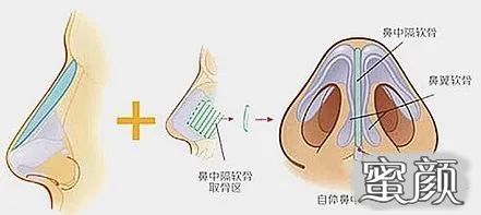 案例图片