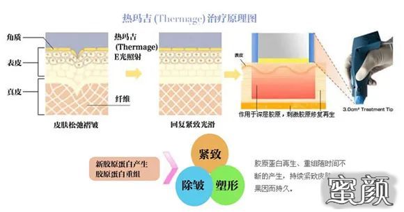 案例图片