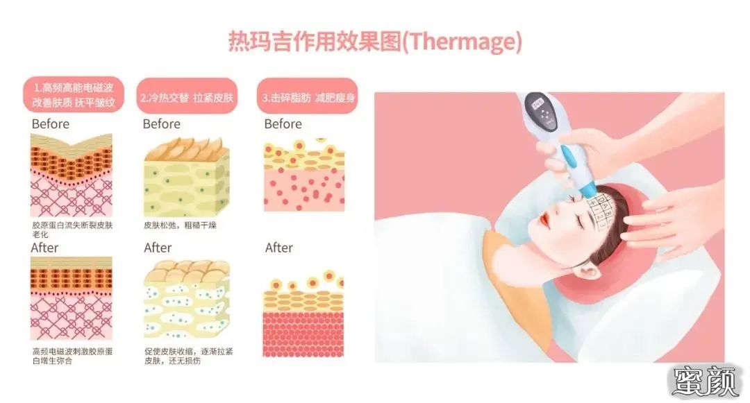 https://img.miyanlife.com/mnt/timg/211107/2223091P8-1.jpg