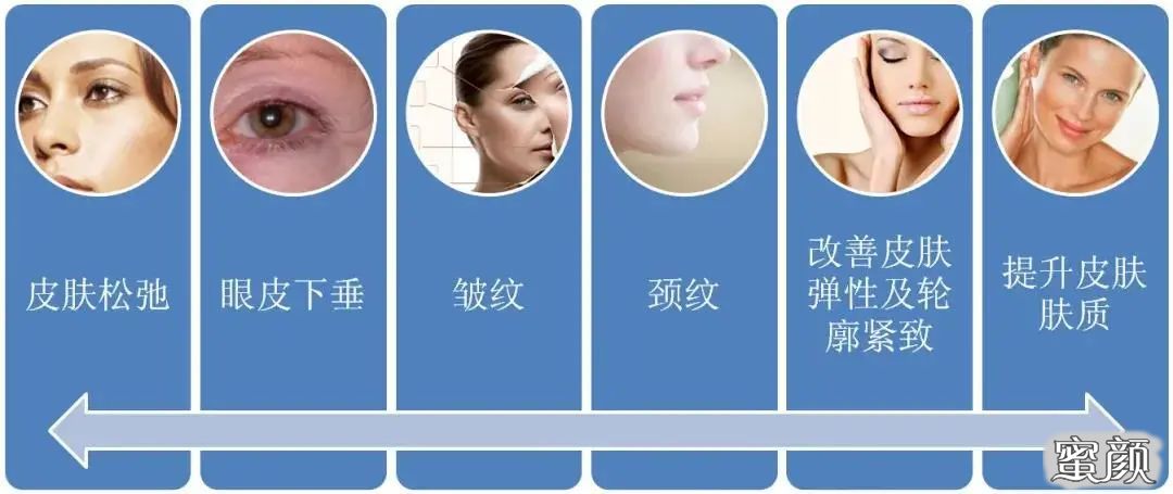 https://img.miyanlife.com/mnt/timg/211107/22231933b-10.jpg
