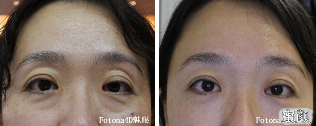 https://img.miyanlife.com/mnt/timg/211108/2246302G9-3.jpg
