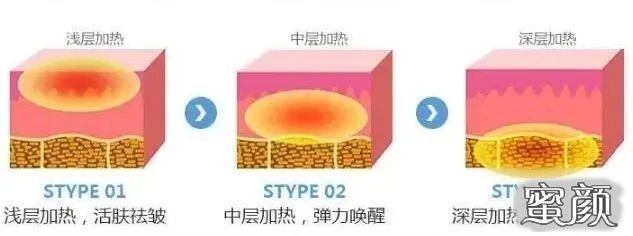 https://img.miyanlife.com/mnt/timg/211111/164512C51-4.jpg