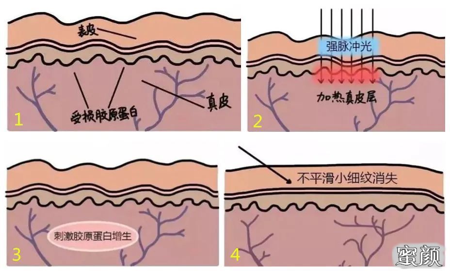 案例图片