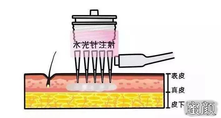 案例图片