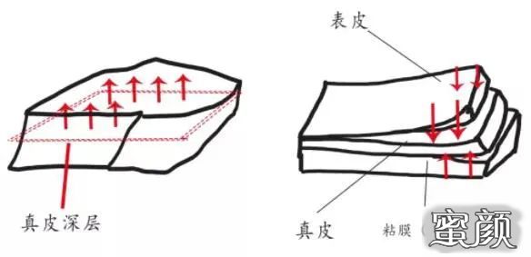 案例图片